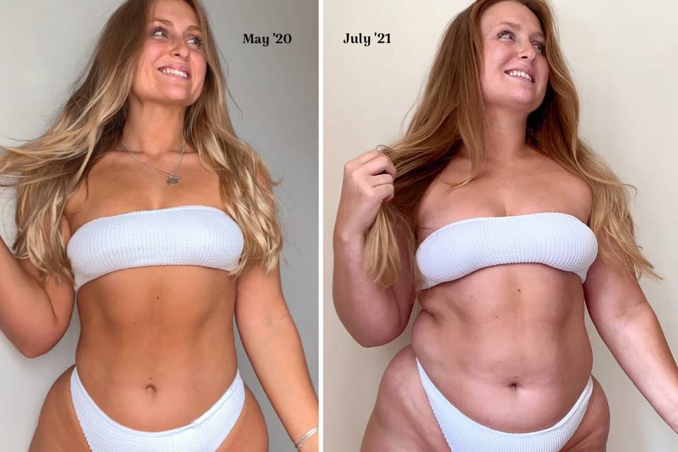 Sophie Lait posing twice two years apart showing the difference in her body and why she is still herself despite any  changes