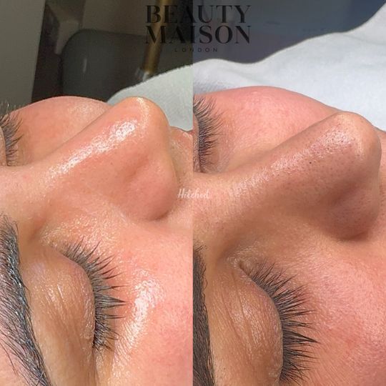 Beauty Maison London