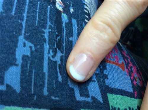 Re: Gel nails-is this normal?