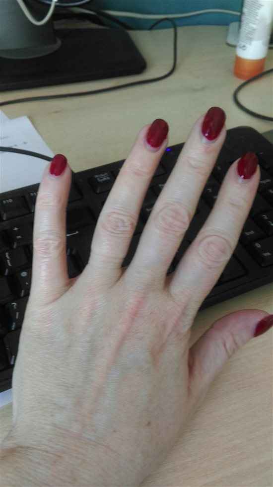 Re: Wedding rings too tight?