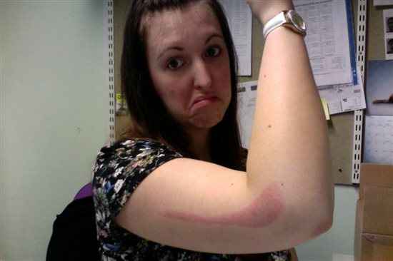 I've always wanted a nice purple streak down my arm....