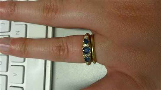 Wedding rings too tight?