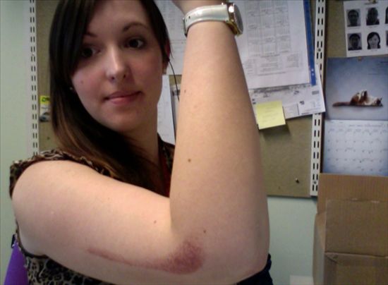 Re: I've always wanted a nice purple streak down my arm....