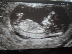 Re: Dear Upduffed of OT