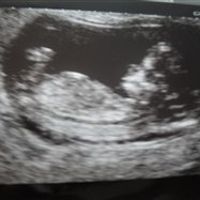 Re: Dear Upduffed of OT