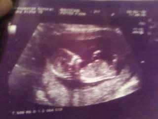 **** Icklefee's wedding report**** complete with ridiculous amount of photos!