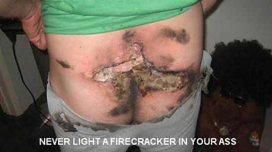Safety reminder for Stupid People (Graphic arse picture lol if eating don't look!)