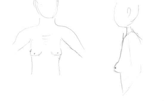 Re: Your Thoughts on Breast Augmentation