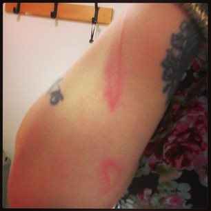 Re: I've always wanted a nice purple streak down my arm....