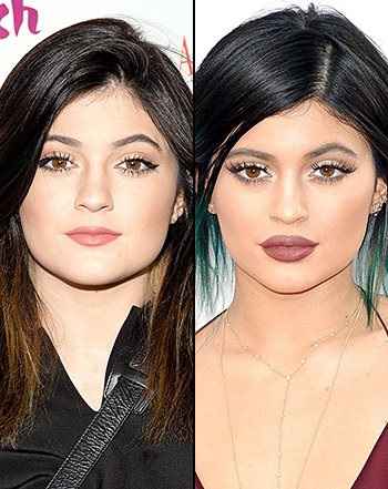 Re: Kylie Jenner