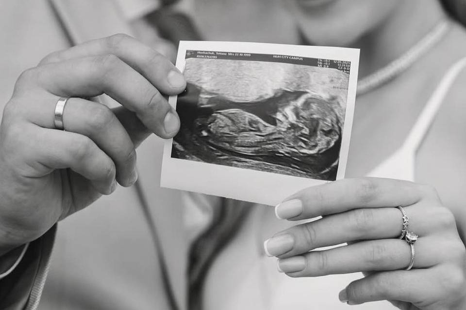 Pregnancy photoshoot