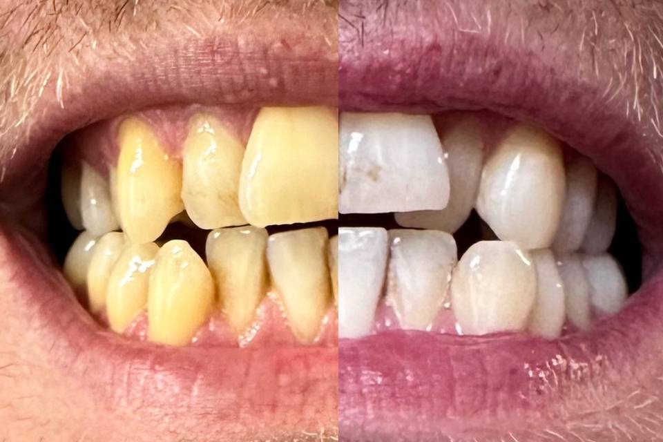Results after 2 sessions
