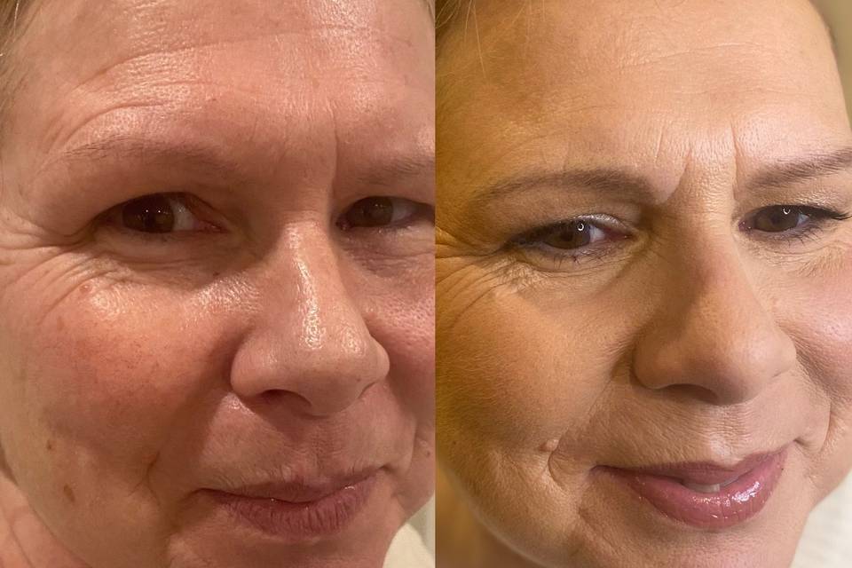 Nicola before & After