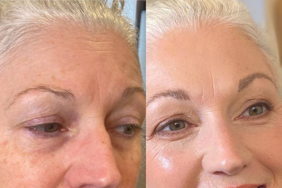 Kerry Before & After