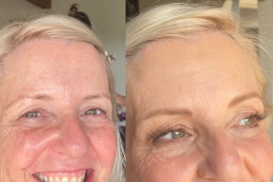 Before and after