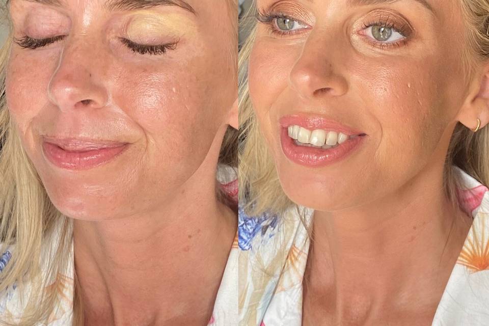 Before & after