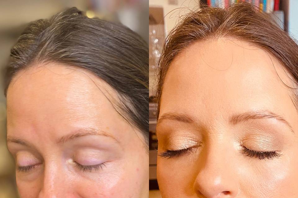 Before & after