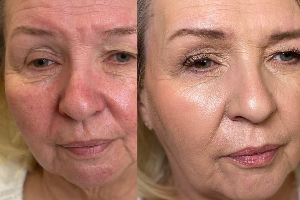 Before & After