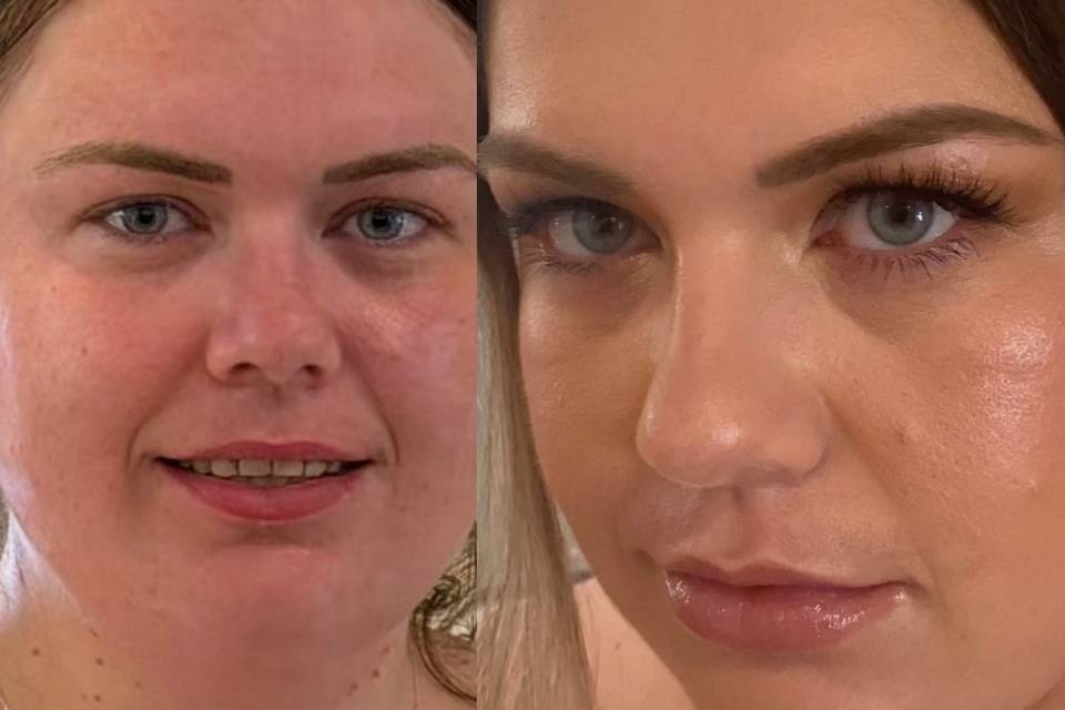 Charlotte before and after