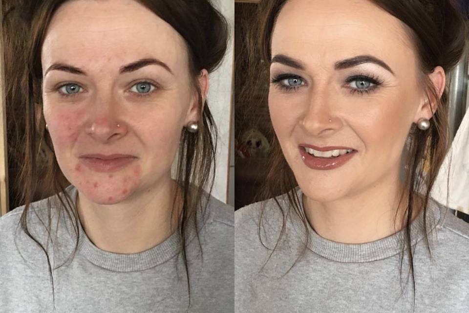 Before and after (skin focus)