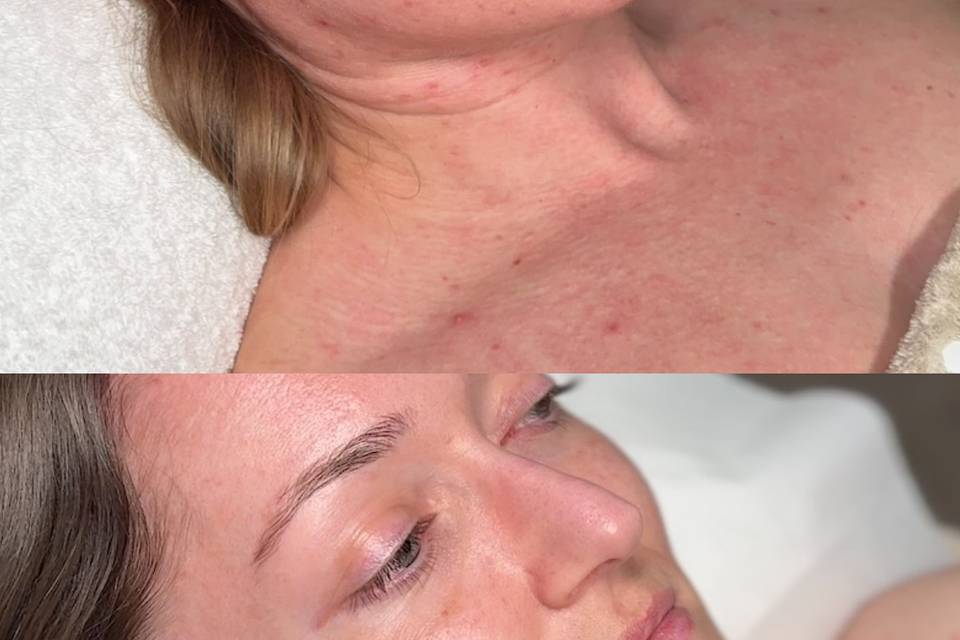 Brides skin progression