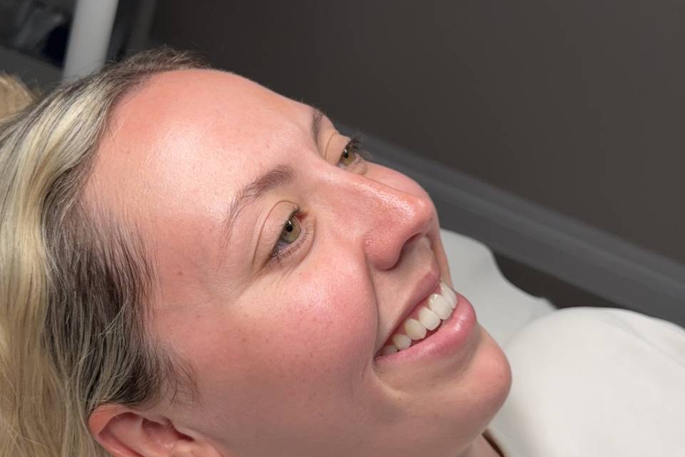 Lucy’s skin journey