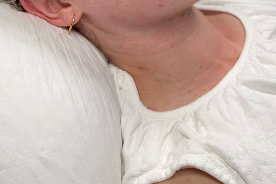 Bethan skin