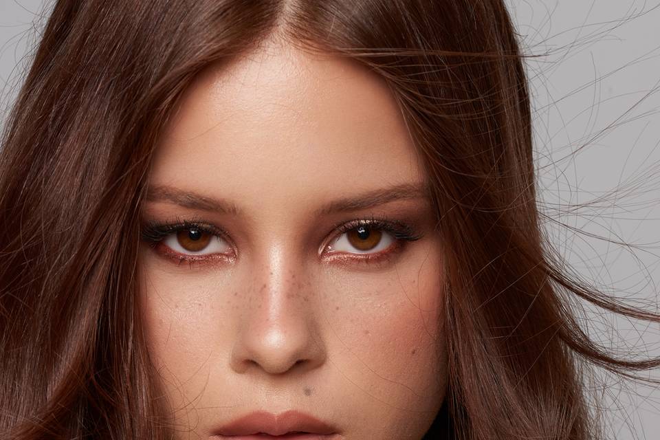 Freckles
