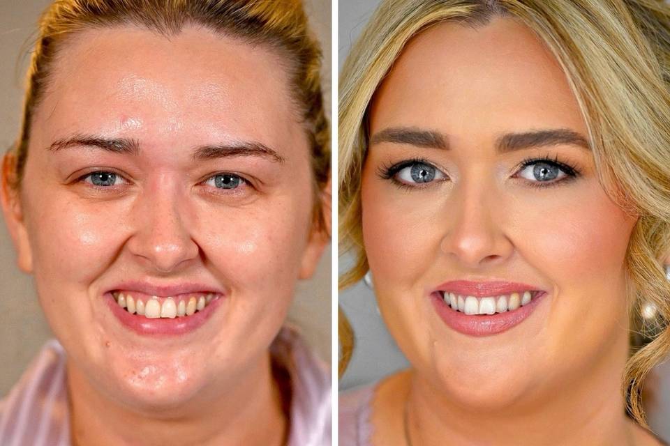 Before and after pinky tones
