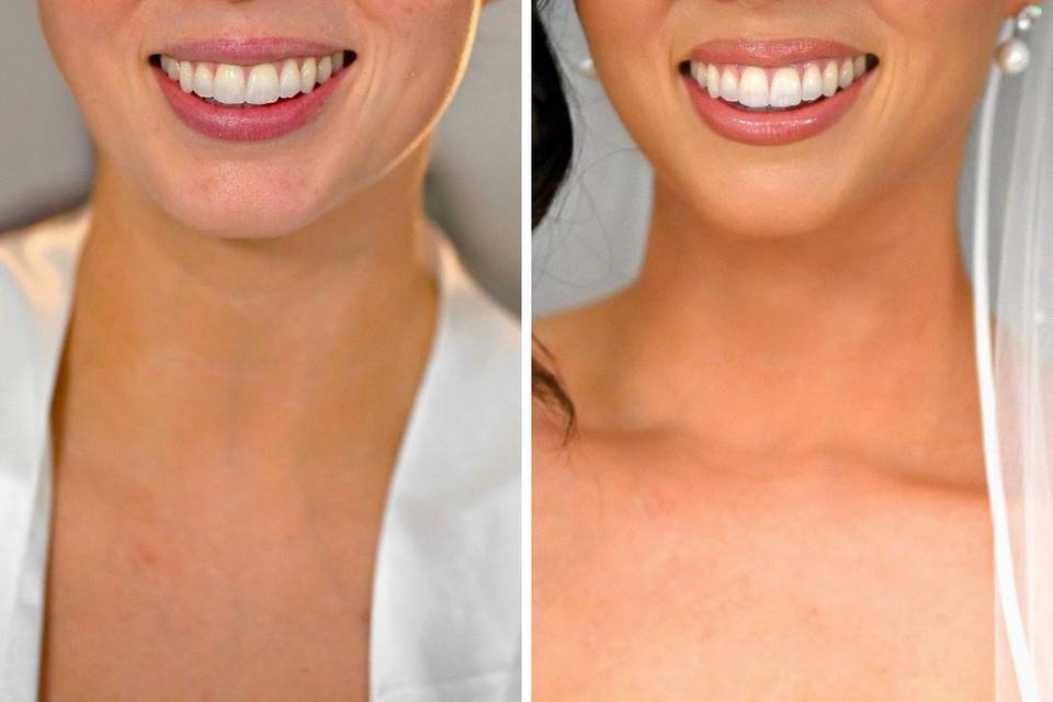 Before and after