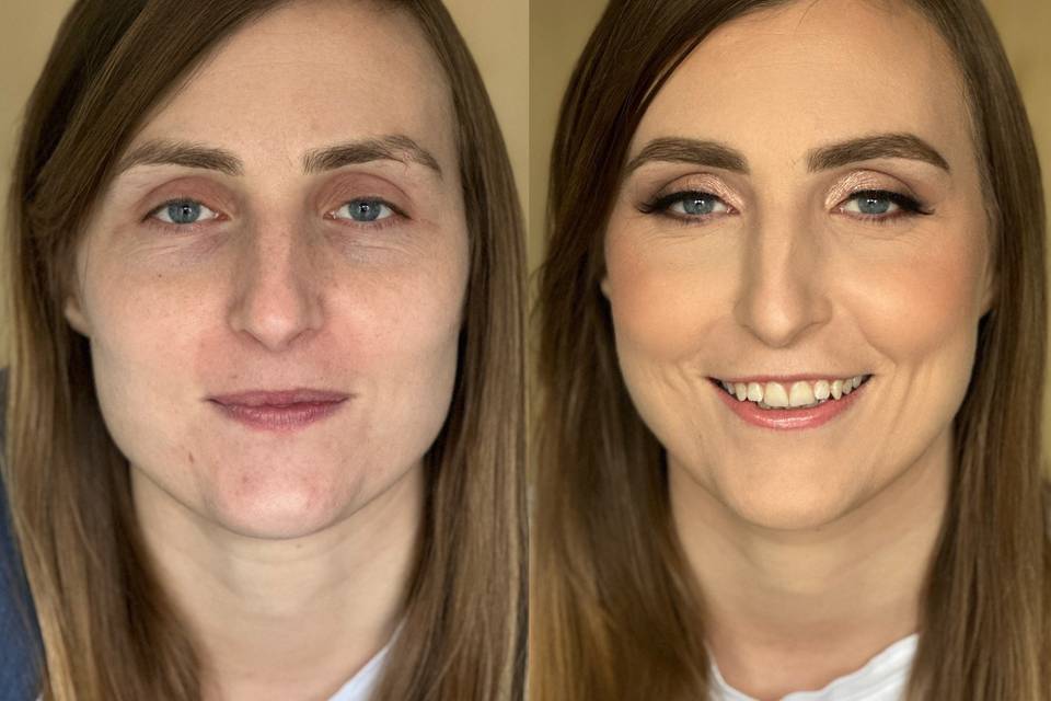 Before and after from a trial