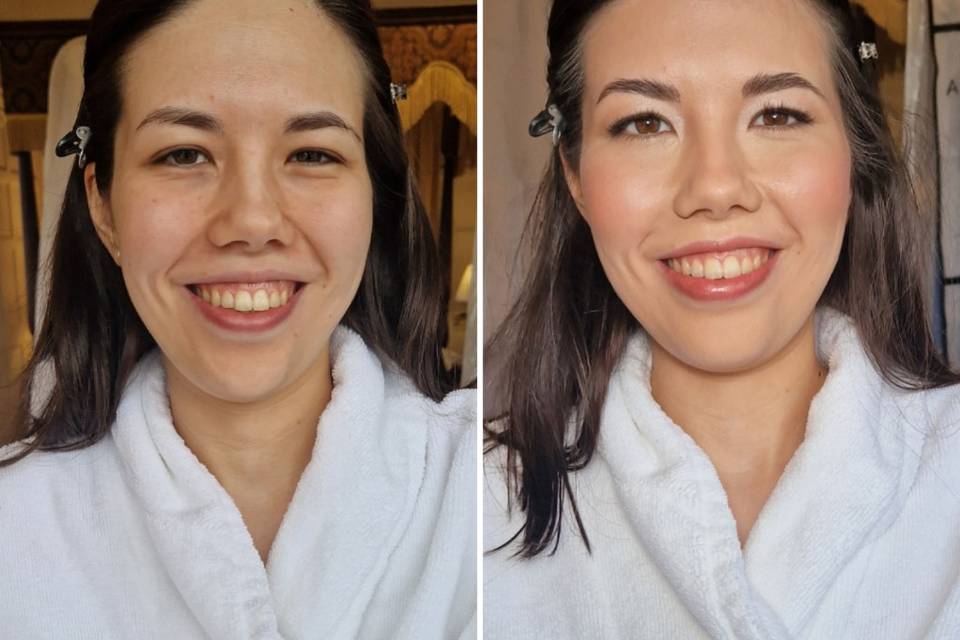 Before and after