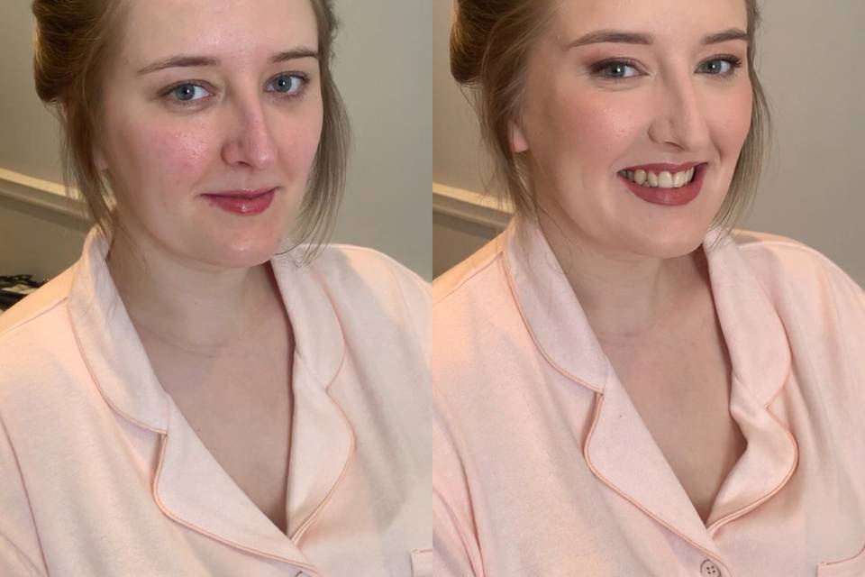 Before and After for Emily