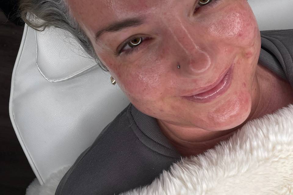 Stunning Glow of our facials