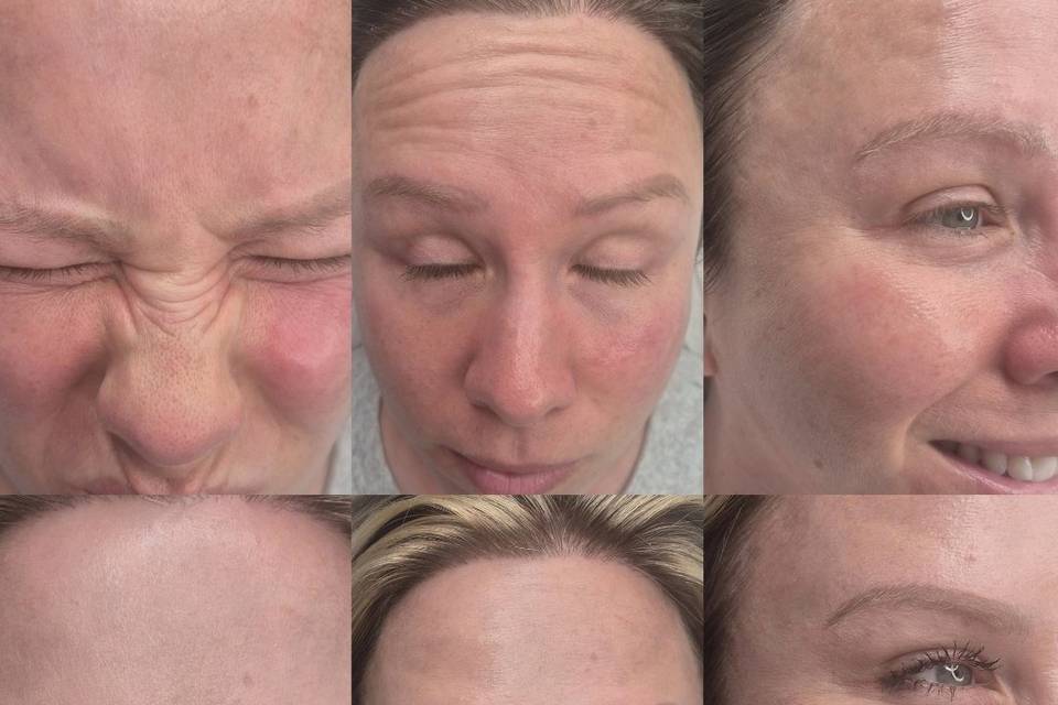Before & After Skin Journey 10