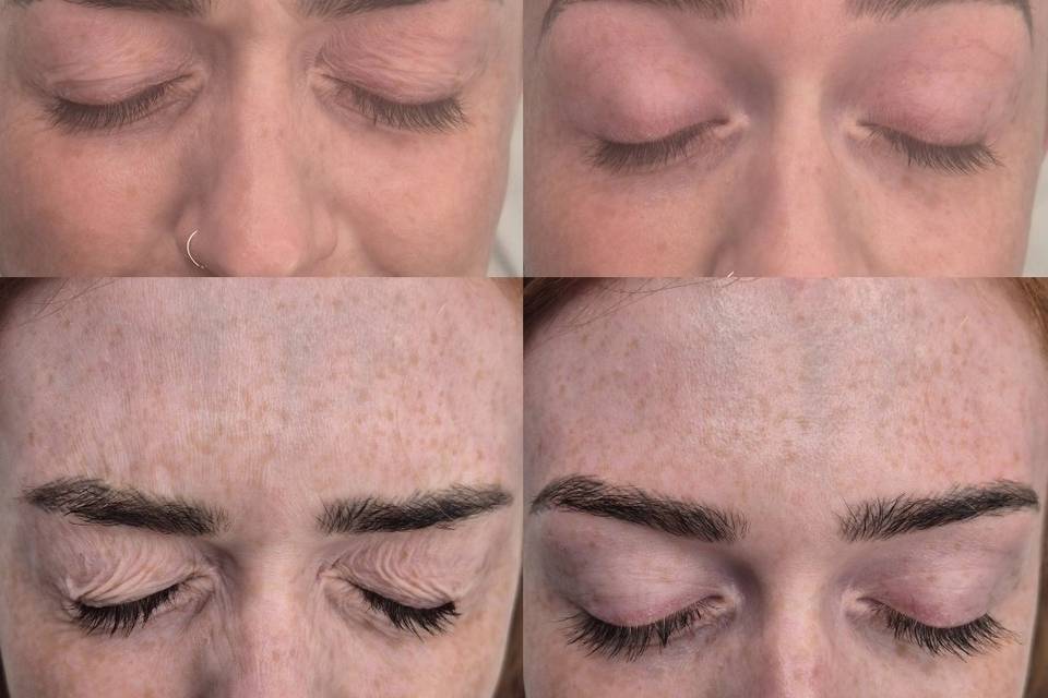 Before & After Skin Journey 13