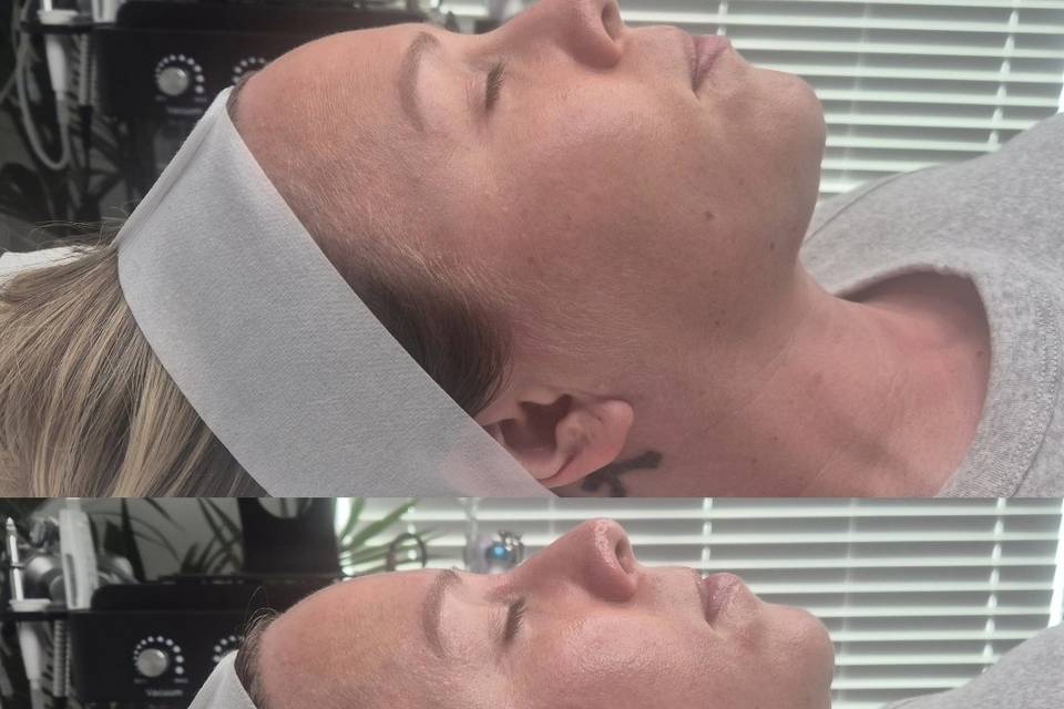 Before & After Skin Journey 19