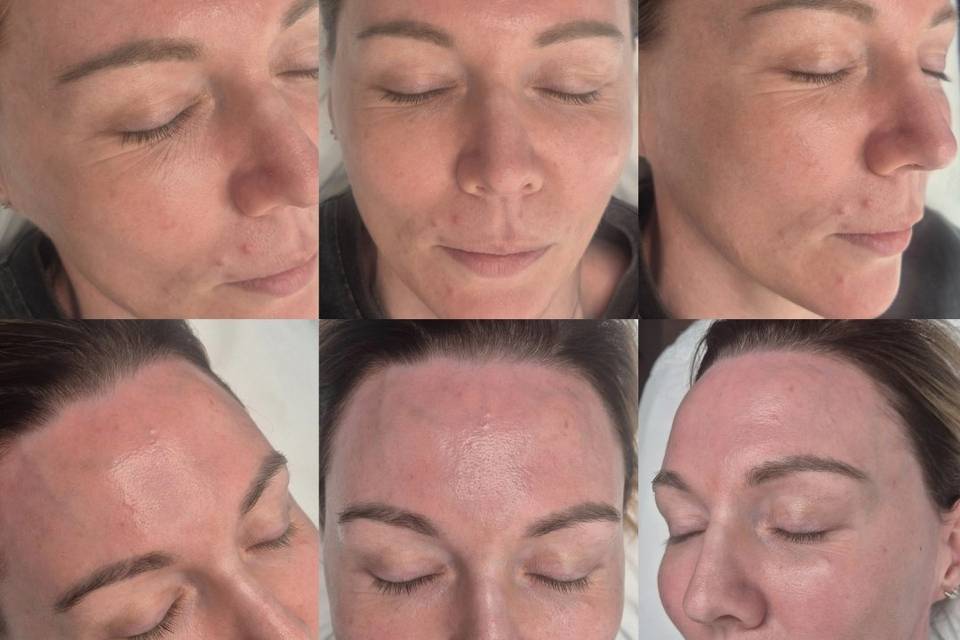 Before & After Skin Journey 7