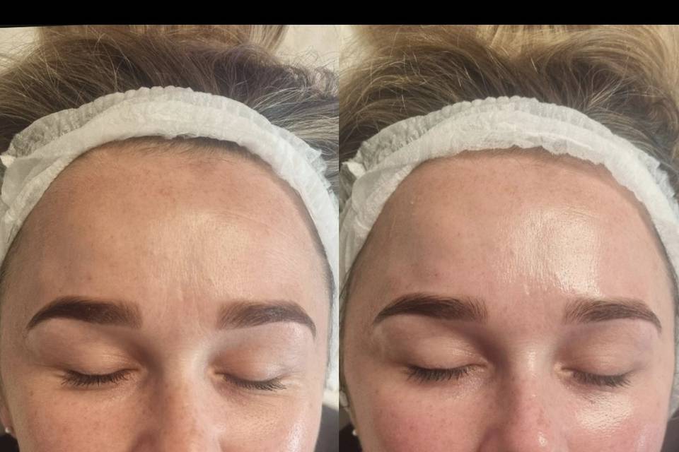 Before & After Skin Journey 9