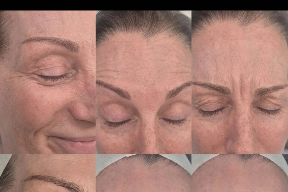 Before & After Skin Journey 11