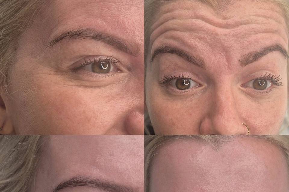 Before & After Skin Journey 16