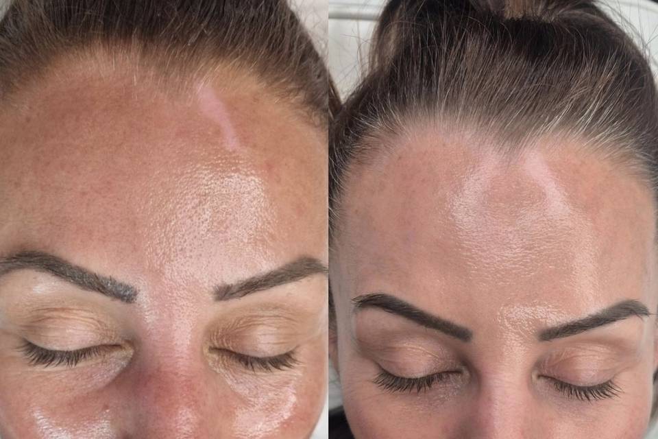 Before & After Skin Journey 4