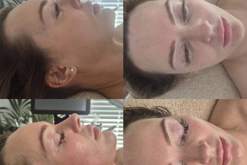Before & After Skin Journey 5