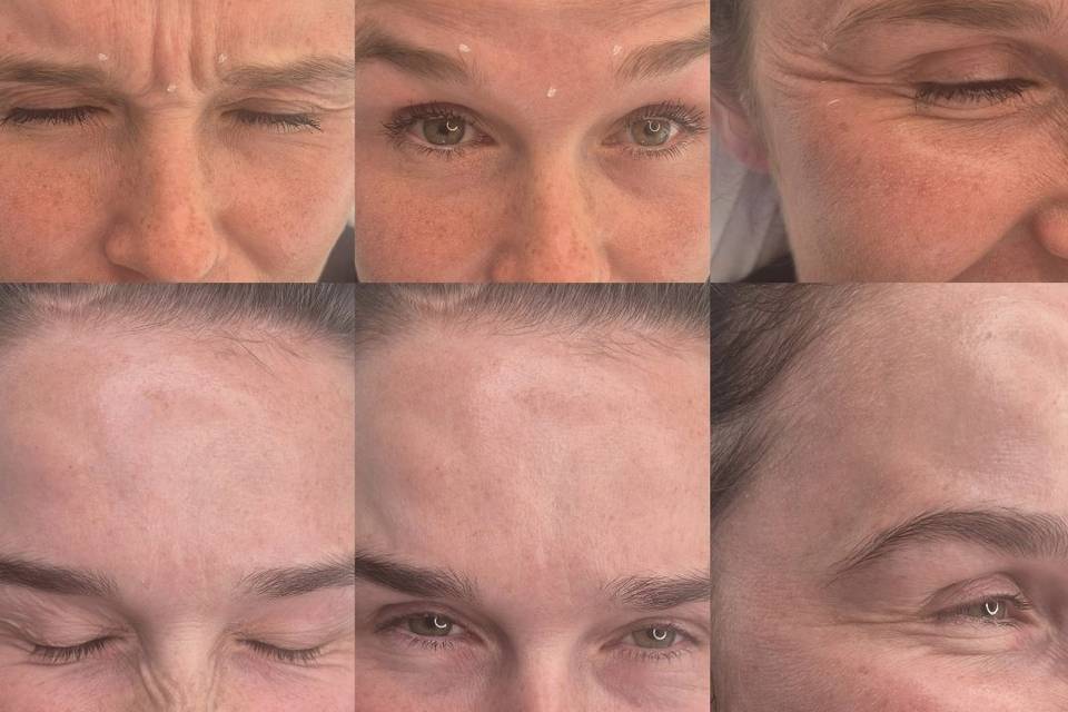 Before & After Skin Journey 12