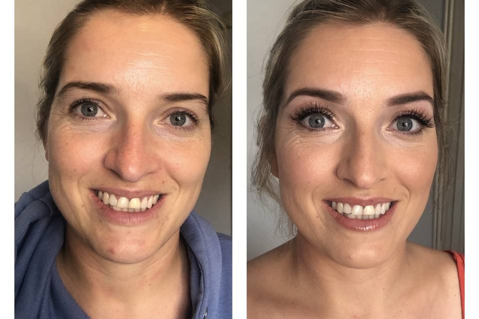 Before and after trial -Rosie