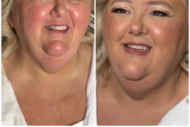 Before and after