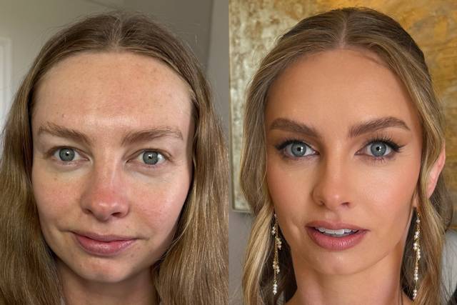 Before/After