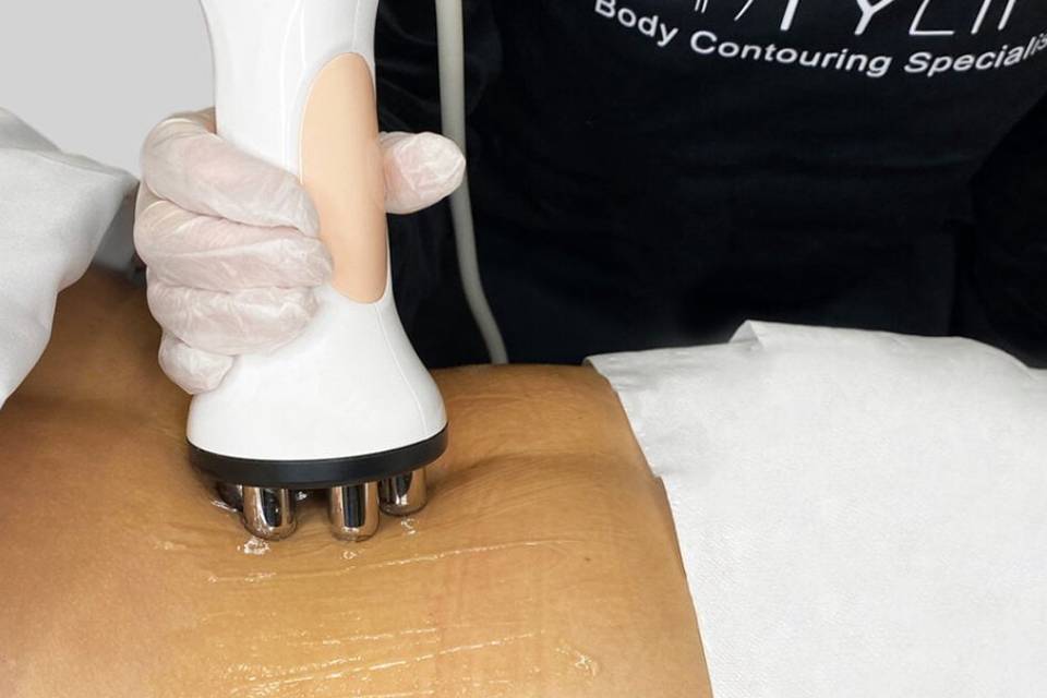 Body contouring procedure