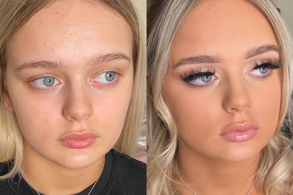 Before and after