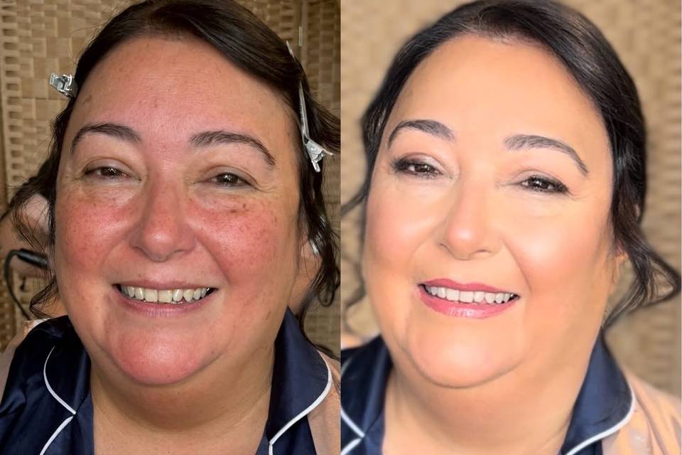 Before and after MOB